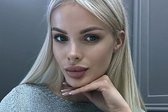 Proveli Trepanaciju Cherepa V Moskve Zhestoko Izbili Insta Model Vrachi Borjutsja Za Ee Zhizn D543357